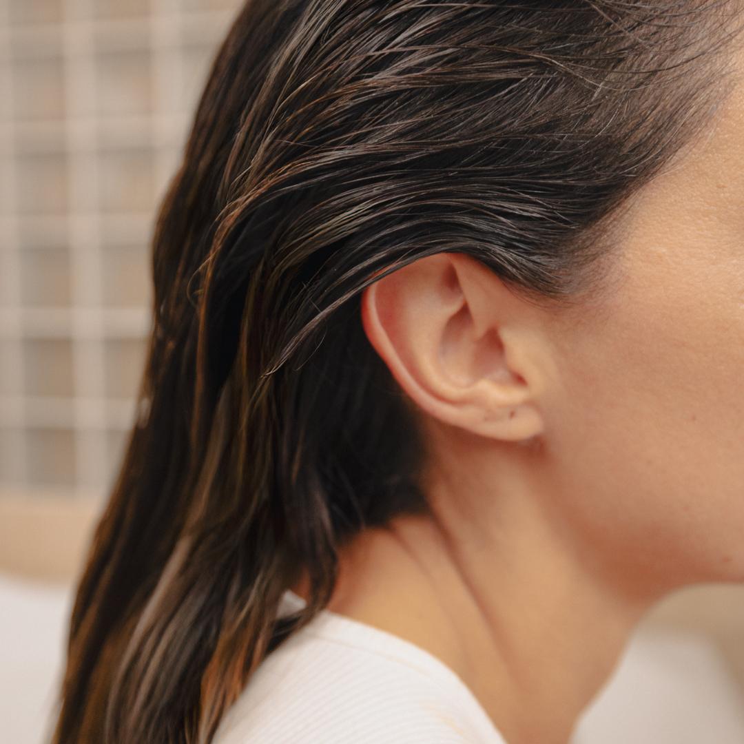 The Postpartum Hair Loss That Did Not Stop