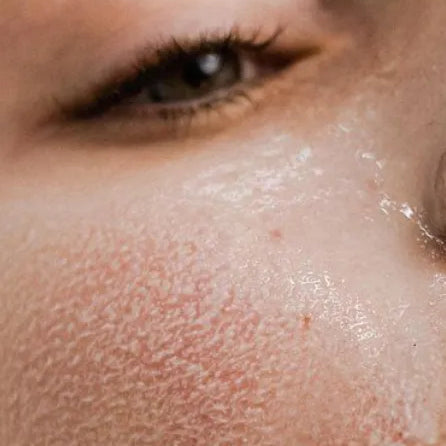 Night Sweats and Sleeplessness: Cooling Down Menopause Insomnia